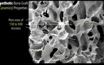 No-Nonsense Recap: Orthobiologics and Bone Substitutes: A Primer