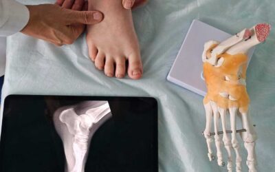 Positive Outcomes of Medial Arch and Hindfoot Reconstruction in Children