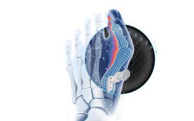 AI-Powered Patient-Matched Lapidus System