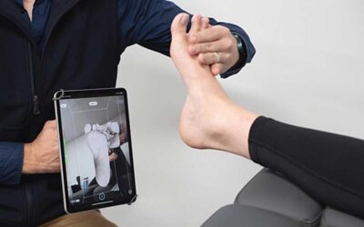 3D Scanning vs. Plaster Casting–Evolving Techniques in Orthotic Capture