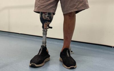 Data-Driven Designs to Improve Prosthetic Legs