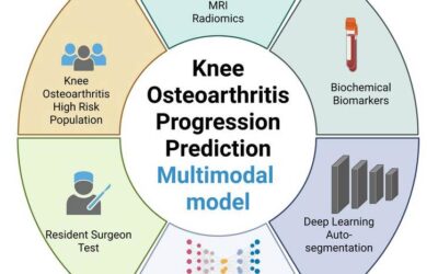 AI-Assisted Model Helps Improve Prediction of Worsening Knee OA
