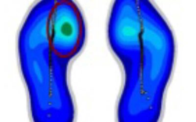 CAGA 101: The 12 Dirty Truths of Foot Mechanics