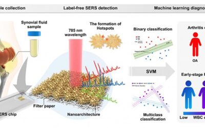 Accurate, Rapid Arthritis Diagnosis Using Synovial Fluid