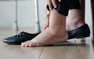 Indoor VS. Regular Custom-Made Footwear for Diabetics at High Risk Of Foot Ulceration