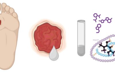 Insulin + Metformin May Be a New DFU Treatment