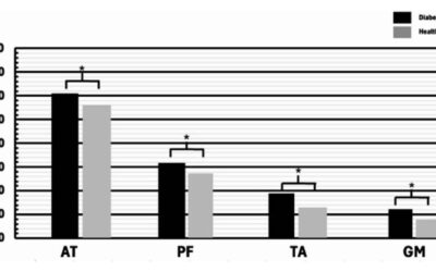 Mechanical Properties of Achilles Tendon and Plantar Fascia in Patients with History of DFU