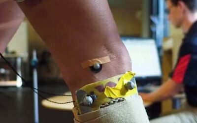 Gait Retraining Eases Pain, Slows Cartilage Damage