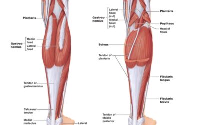 Cutting Edge Treatment of Chronic  Mid-substance Achilles Tendinosis