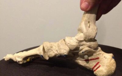 Dirty Truth: #7 You Can’t Avoid It, Repetitive Microtrauma