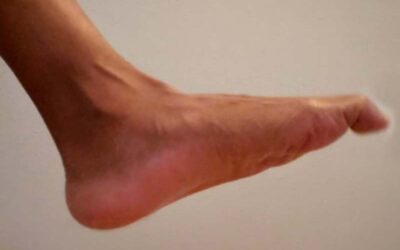 Sensory Input is Needed for Motor Output–The Foot of the Matter