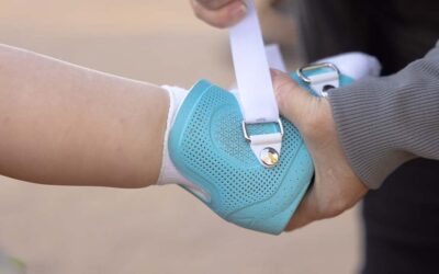 3D-Printed Pediatric Supramalleolar Orthosis