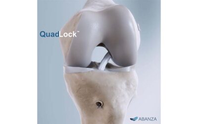 Fixation Device for ACL Reconstruction