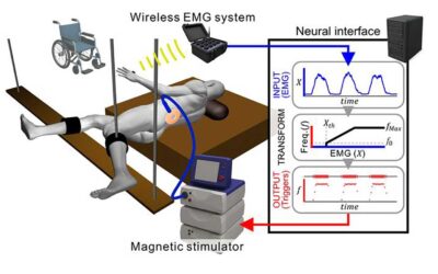 Noninvasive Spinal Stimulation Enables Patients with Paraplegia to Regain Stepping Control