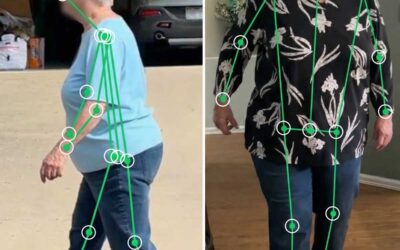 Knee Instability in Osteoarthritis
