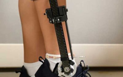 Researchers Explore AFOs for Treating Achilles Tendinopathy