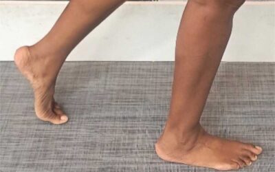 Is Neutral Enough for Ankle Dorsiflexion?