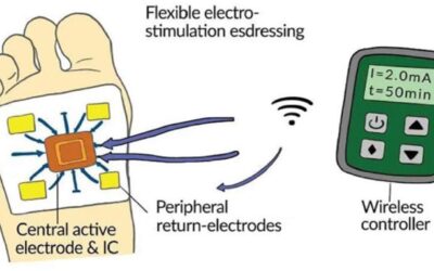Electrical Stimulation: Novel Therapy for Diabetic Foot Ulcers