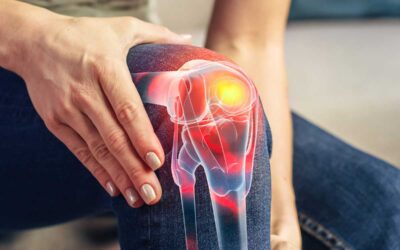 Knee Crepitus and Osteoarthritis in Young Adults Following Traumatic Knee Injury