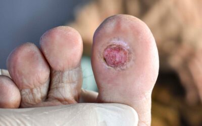 Closing the Loop on “Frequent Flyers”