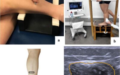Assessment of Peroneal Muscles Using Ultrasound in CAI