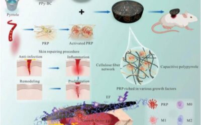 Smart Hydrogel Accelerates Diabetic Wound Healing