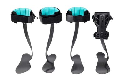 Emerging Developments in AFOs Part 3: Making Carbon Composite AFOs Work in Podiatric Practice