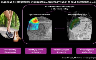 Study Sheds Light on Why Tendons Are Prone to Injury