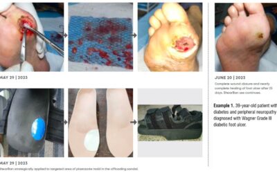 Targeted Protection Against Friction and Shear Forces