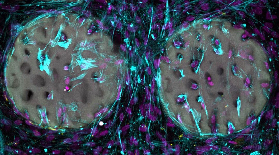 Jelly-like Material Used to Produce Bone Implants