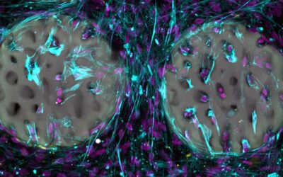 Jelly-like Material Used to Produce Bone Implants