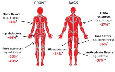 Muscle strength loss discriminates.