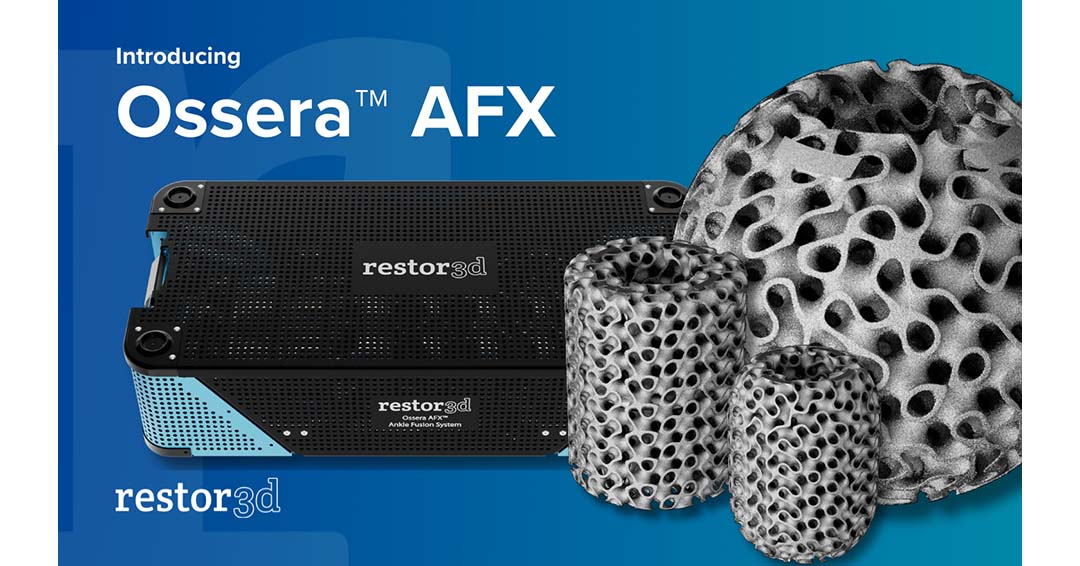 Ankle Fusion Cage System