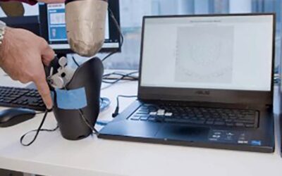 Customizable 3D-Printed Socket Is Lightweight, More Comfortable