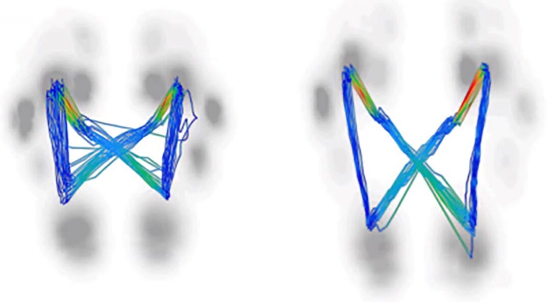 CAGA 101: The 12 Dirty Truths of Foot Mechanics