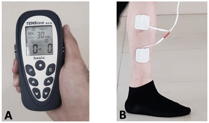 Effect of Otago Exercise Program with Neuromuscular Electrical Stimulation on CAI