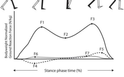 The Relationship Between Clinical Outcomes and Gait Biomechanics in PF