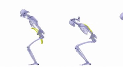 Generative AI Can Help Athletes Avoid Injuries