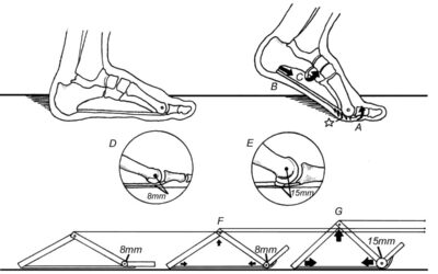 Rethinking the Role of the Plantar Fascia’s Windlass Mechanism